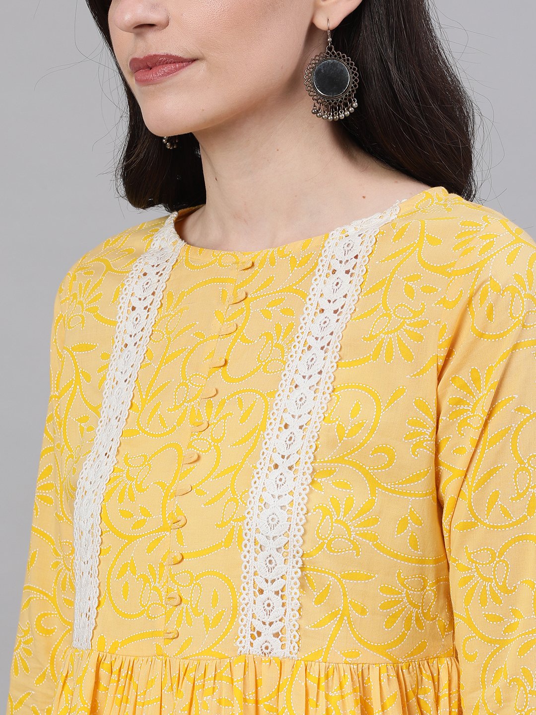 Women Yellow front yoke lace detail printed dress | NOZ2TOZ - Made In INDIA.